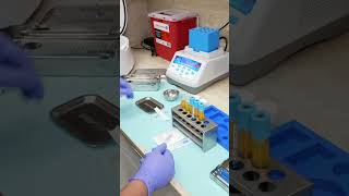 IN OFFICE IV INFUSION AND PHLEBOTOMY prfedu skincare ivf infusion prf prfedu phlebotomy [upl. by Dabbs]