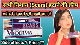 Mederma cream  mederma for acne scars  mederma advanced scar gel review [upl. by Furnary]