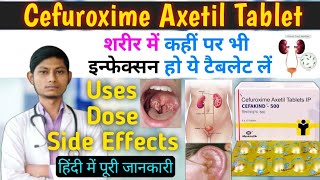 Cefuroxime axetil 500 mg  cefakind 500 mg tablet uses in hindi  Cefuroxime tablets ip 500mg [upl. by Dzoba]