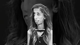 Such a powerful mentality to have…  Lizzie Velasquez X lifetodaytv [upl. by Hurwit]