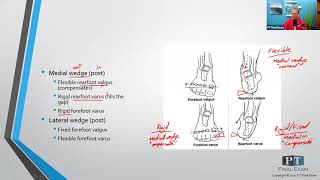 Forefoot and Rearfoot Deformities [upl. by Arval]