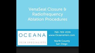 VenaSeal amp Radiofrequency Ablation for Varicose Veins at Oceana Vein Specialists in Oceanside CA [upl. by Kerin]