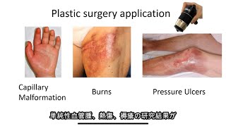 Capillaroscope Essentials 4 Plastic Surgery Research Dr Kento Yamamoto GOKO Webinar for IMC [upl. by Dewayne]