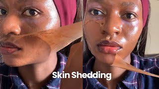 Skin Shedding [upl. by Arrik]