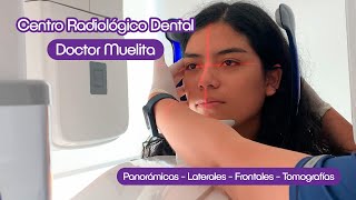 🦷 Ahora en Doctor Muelita contamos con nuestro propio CENTRO RADIOLÓGICO DENTAL [upl. by Yroger903]