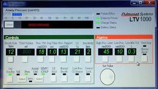 THE SELECT BUTTON ON LTV VENTILATORS EXPLAINED [upl. by Nylevol335]