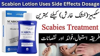 what is scabiessymptomstreatmentscabion lotionuseshow to apply scabies [upl. by Ecniv556]