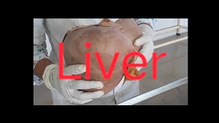 Liver dissection human liverviralvideo [upl. by Cockburn]