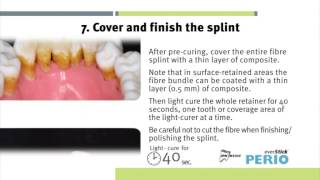 Instructions for use everStickPERIO glassfibre reinforcement for periodontal splinting [upl. by Enoved]