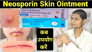 Neomycin and polymyxin b sulfates and bacitracin zinc ointment usp in hindi  neosporin ointment [upl. by Halonna]