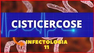 CISTICERCOSE  TAENIA SOLIUM  PARASITOLOGIA  INFECTOLOGIA [upl. by Demitria]