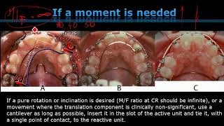 Clip from Biomechanics Online Course 19 [upl. by Enneillij]