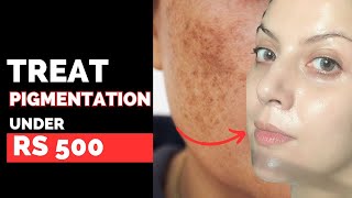 The 5 Best Products To Treat Pigmentation Under Rs 500  Nipun Kapur [upl. by Nesyaj]