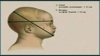 Présentations du front et bregma [upl. by Medea]