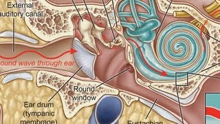 What Is a Middle Ear Infection  Ear Problems [upl. by Terrene]