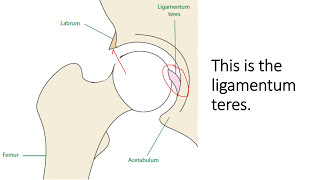 Loose Hip Joint What Does this Mean and Can It Be Treated [upl. by Roldan]