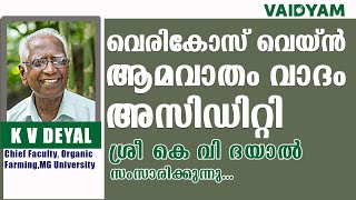 vericose vein Amavatham acidity kvdayal vaidyam ayurveda [upl. by Ynnob]