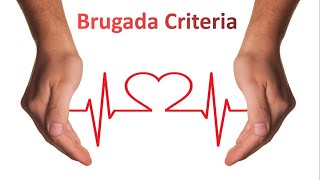 Brugada Criteria for VT vs SVT I ECG Made Super Easy [upl. by Ahsinam]