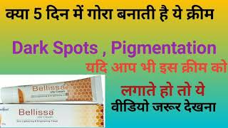 Bellissa lite Cream क्या चेहरे को बिना किसी Side effects के गोरा बनाती है [upl. by Selrahcnhoj]