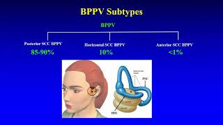 BPPV  Preliminary Insights [upl. by Roshan369]