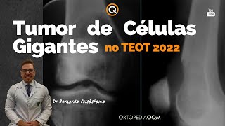 Tumor de Células Gigantes TCG no TEOT 2022 Por Dr Bernardo Crisóstomo OQM TEOT [upl. by Norha423]