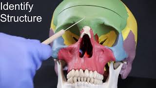 Skull Quiz Part I Frontal Parietal Temporal and Occipital Bones [upl. by Kathye]