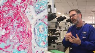 Microscope tutorial  Troubleshooting the MSB stain [upl. by Lash82]