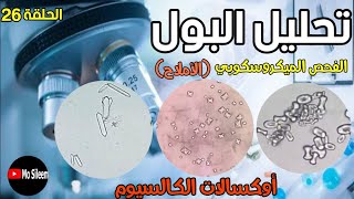 Urinalysis 26 microscopic ex crystals Calcium oxalate [upl. by Anilah323]