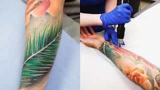 How does laser tattoo removal work – Blue green red and black ink [upl. by Ellevart]