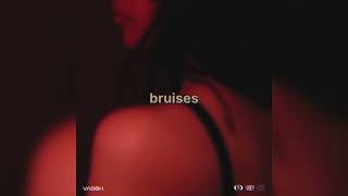 Vaboh  Bruises Official Audio [upl. by Odracer]