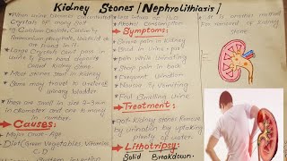 Kidney stonesNephrolithiasisCausesSymptoms and Treatmenteducationalvideoseducation [upl. by Neahs]