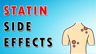 Side Effects of Statins [upl. by Olotrab]