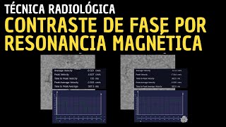 Técnica Radiológica Contraste de fase por Resonancia Magnética [upl. by Sitoel]