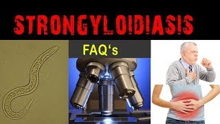 What is Strongyloidiasis   FAQ and answers [upl. by Bunns]