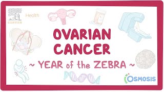 Ovarian cancer Year of the Zebra [upl. by Holmes413]