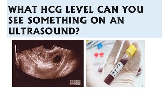 what beta hcg level can you see pregnancy on ultrasoundWhen gestational sac become visible on usg [upl. by Meeharb]