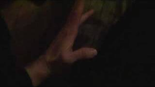 Mild hypokalemic periodic paralysis attack hand 20100113211503mpg [upl. by Ingeberg]