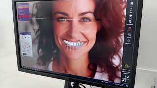 Digitales SmileDesign bei DenisFocus Dental Zahnklinik in Ungarn [upl. by Naasar]