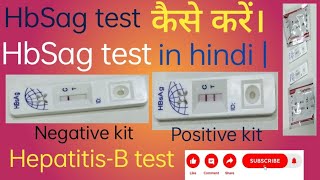 HbSag test कैसे करें। HbSag test in hindi  HepatitisB test [upl. by Tabbatha]