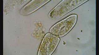 Paramecium Dividing [upl. by Muhcan]