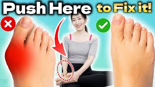 Instant Bunion Pain Relief Massage  How to Fix Bunions Naturally at Home [upl. by Timofei473]