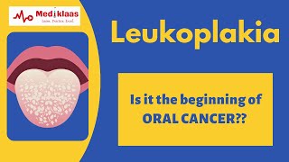 Leukoplakia l Precancerous lesions l Oral pathology l Mediklaas [upl. by Nebuer]