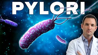 El Helicobacter Pylori Puede Estar Detrás de Tu Dolor de Espalda [upl. by Geof]