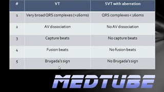 VT vs SVT with aberrancy Made Easy [upl. by Schroth931]