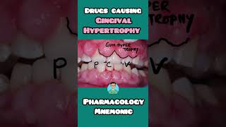 Drugs causing gum Hypertrophy mnemonics for inicet usmle neetpg firstaidusmle pharmacology [upl. by Syck]