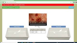 Experiment 22 Study of anti ulcer activity  using pylorus ligation method or SHAY method [upl. by Rheinlander]