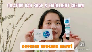 Oilatum Bar Soap amp Emollient Cream Review  Nawala agad ang Bungang araw ng baby ko [upl. by Elenahc316]