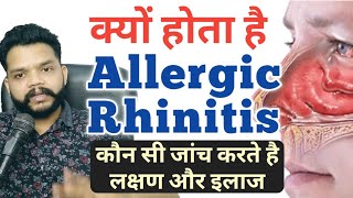 Allergic Rhinitis Causes Symptoms Prevention amp Treatment In Hindi  Gyanear [upl. by Nivre]