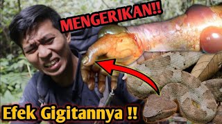 PARAH EFEK GIGITAN ULAR INI SANGAT MENGERIKAN HATI HATI ULAR BERBISA DISEKITAR KITA [upl. by Ahtenek]