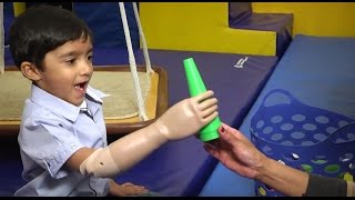 Prosthetic Myoelectric Arm Changes Childs Life [upl. by Benenson]